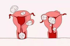 ù��������֢״